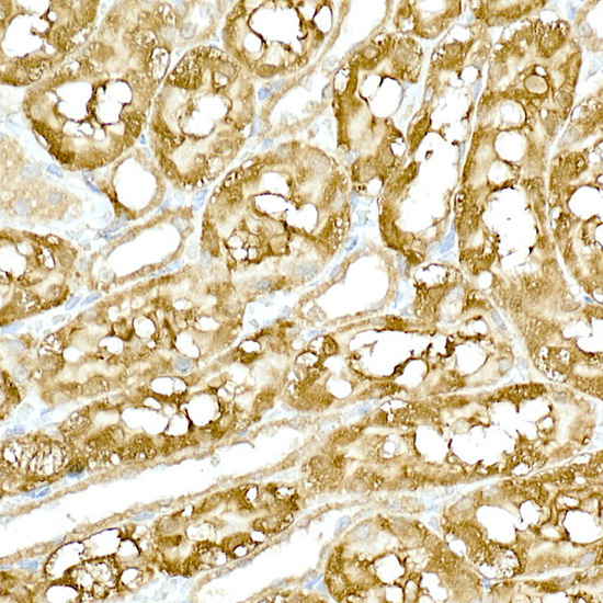 TBK1/NAK Rabbit Polyclonal Antibody - Image 4