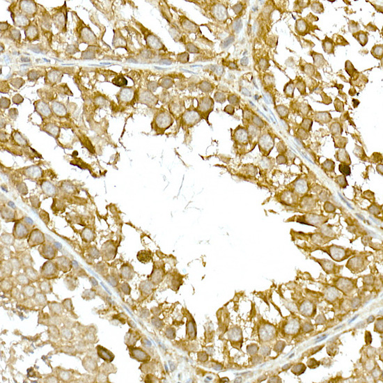TBK1/NAK Rabbit Polyclonal Antibody - Image 5
