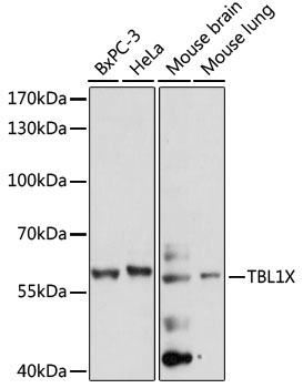 TBL1X Rabbit Polyclonal Antibody