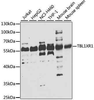 TBL1XR1 Rabbit Polyclonal Antibody