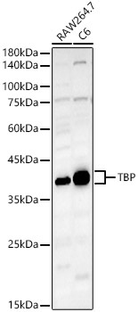 TBP Rabbit Polyclonal Antibody