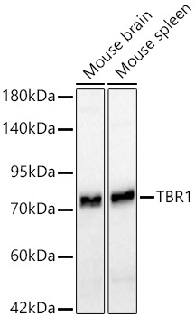 TBR1 Rabbit Monoclonal Antibody