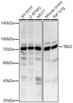 TBX2 Rabbit Polyclonal Antibody