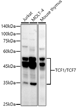 TCF1/TCF7 Rabbit Monoclonal Antibody
