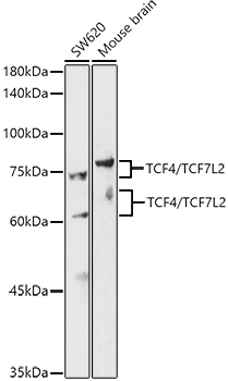 TCF4/TCF7L2 Rabbit Polyclonal Antibody