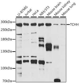 TCHH Rabbit Polyclonal Antibody