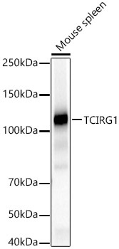 TCIRG1 Rabbit Polyclonal Antibody