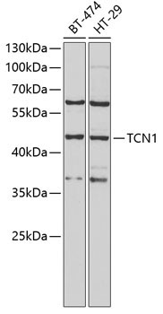 TCN1 Rabbit Polyclonal Antibody