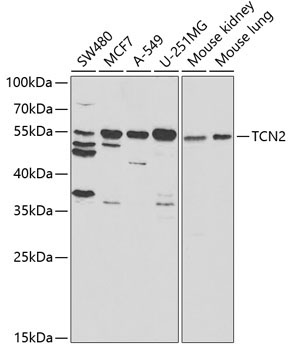 TCN2 Rabbit Polyclonal Antibody