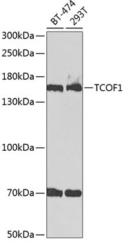 TCOF1 Rabbit Polyclonal Antibody