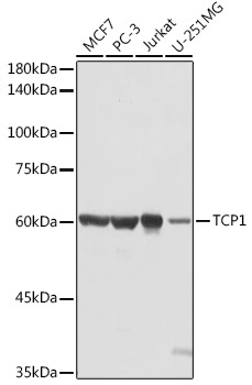 TCP1 Rabbit Polyclonal Antibody