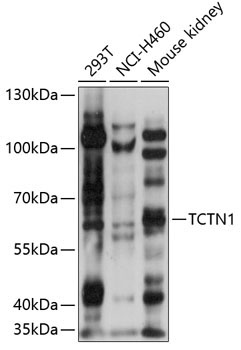TCTN1 Rabbit Polyclonal Antibody