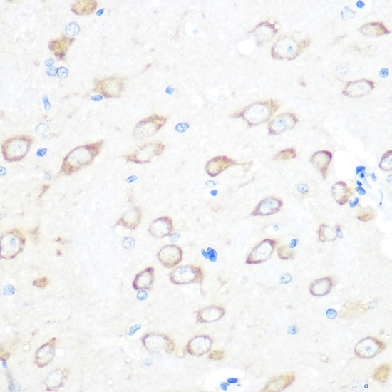 TCTP/TPT1 Rabbit Monoclonal Antibody - Image 2