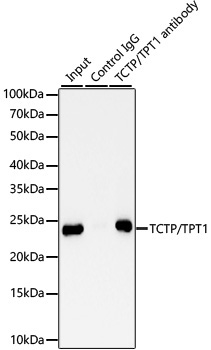 TCTP/TPT1 Rabbit Monoclonal Antibody - Image 3