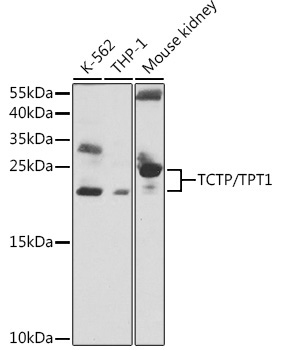 TCTP/TPT1 Rabbit Polyclonal Antibody