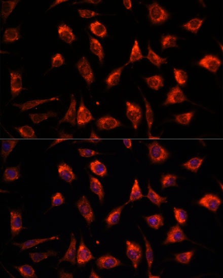 TCTP/TPT1 Rabbit Polyclonal Antibody - Image 2