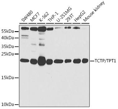 TCTP/TPT1 Rabbit Polyclonal Antibody