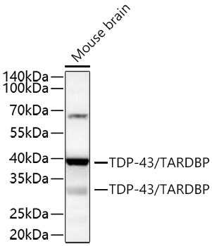 TDP-43/TARDBP Rabbit Monoclonal Antibody