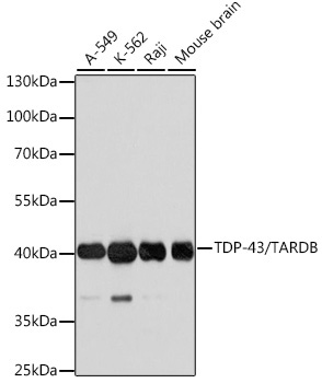 TDP-43/TARDBP Rabbit Polyclonal Antibody