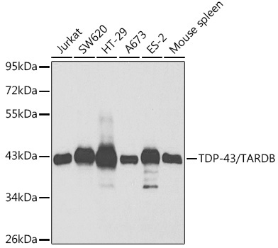 TDP-43/TARDBP Rabbit Polyclonal Antibody