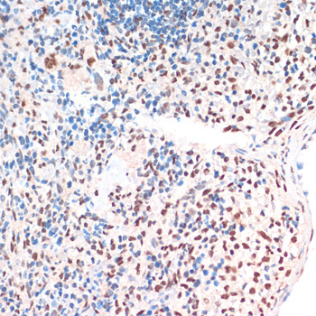 TDP-43/TARDBP Rabbit Polyclonal Antibody - Image 2