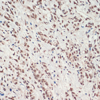 TDP-43/TARDBP Rabbit Polyclonal Antibody - Image 3