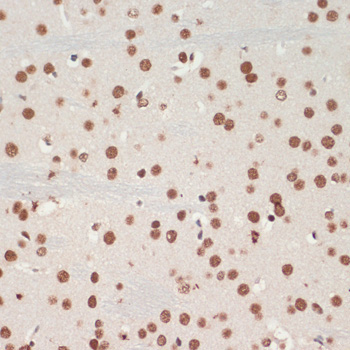 TDP-43/TARDBP Rabbit Polyclonal Antibody - Image 4