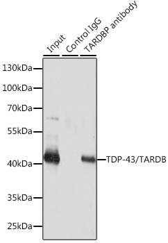 TDP-43/TARDBP Rabbit Polyclonal Antibody - Image 5