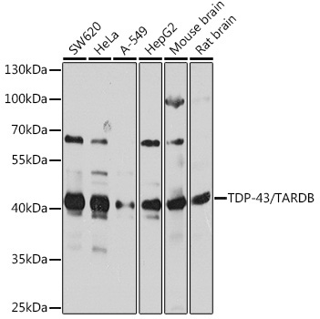 TDP-43/TARDBP Rabbit Polyclonal Antibody