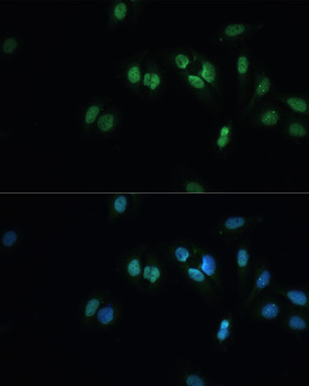 TDP-43/TARDBP Rabbit Polyclonal Antibody - Image 2