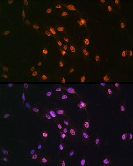 TDP-43/TARDBP Rabbit Polyclonal Antibody - Image 3
