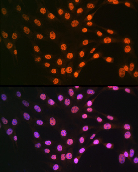 TDP-43/TARDBP Rabbit Polyclonal Antibody - Image 4