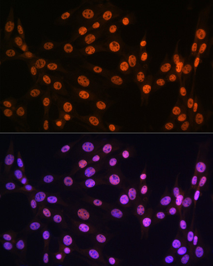 TDP-43/TARDBP Rabbit Polyclonal Antibody - Image 5