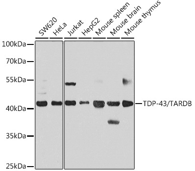 TDP-43/TARDBP Rabbit Polyclonal Antibody - Image 6