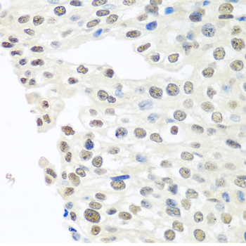 TDP-43/TARDBP Rabbit Polyclonal Antibody - Image 7