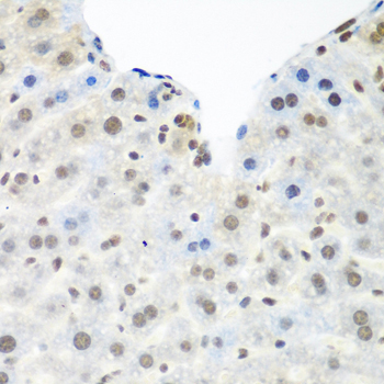 TDP-43/TARDBP Rabbit Polyclonal Antibody - Image 8