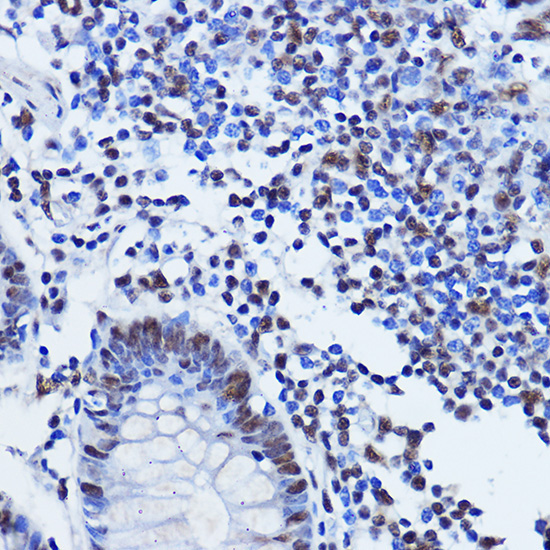 TDP-43/TARDBP Rabbit Polyclonal Antibody - Image 9