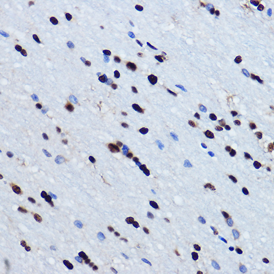 TDP-43/TARDBP Rabbit Polyclonal Antibody - Image 10