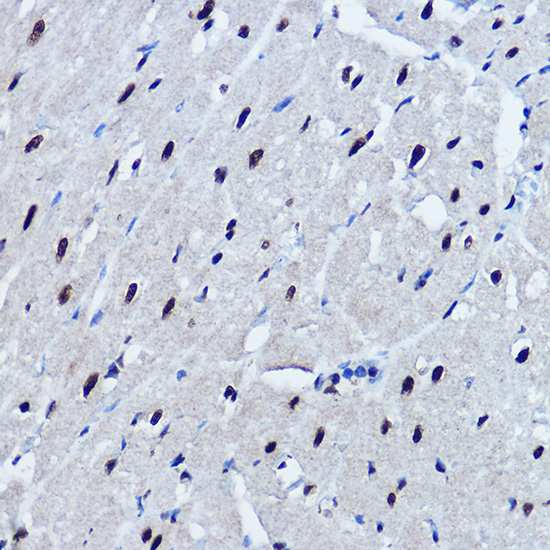 TDP-43/TARDBP Rabbit Polyclonal Antibody - Image 11