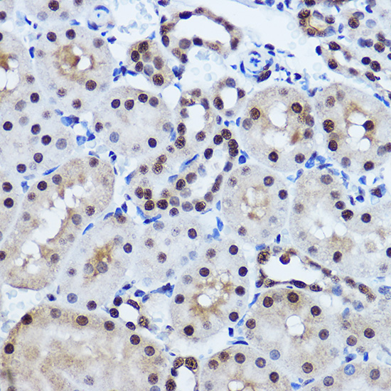 TDP-43/TARDBP Rabbit Polyclonal Antibody - Image 12