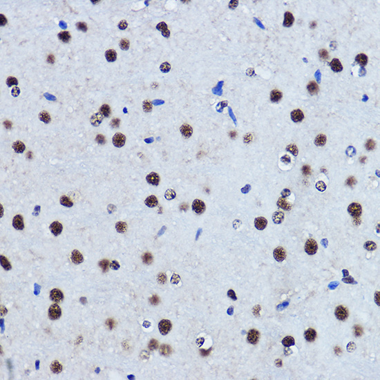TDP-43/TARDBP Rabbit Polyclonal Antibody - Image 13
