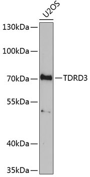 TDRD3 Rabbit Polyclonal Antibody