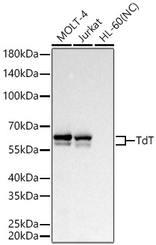 TdT Rabbit Monoclonal Antibody