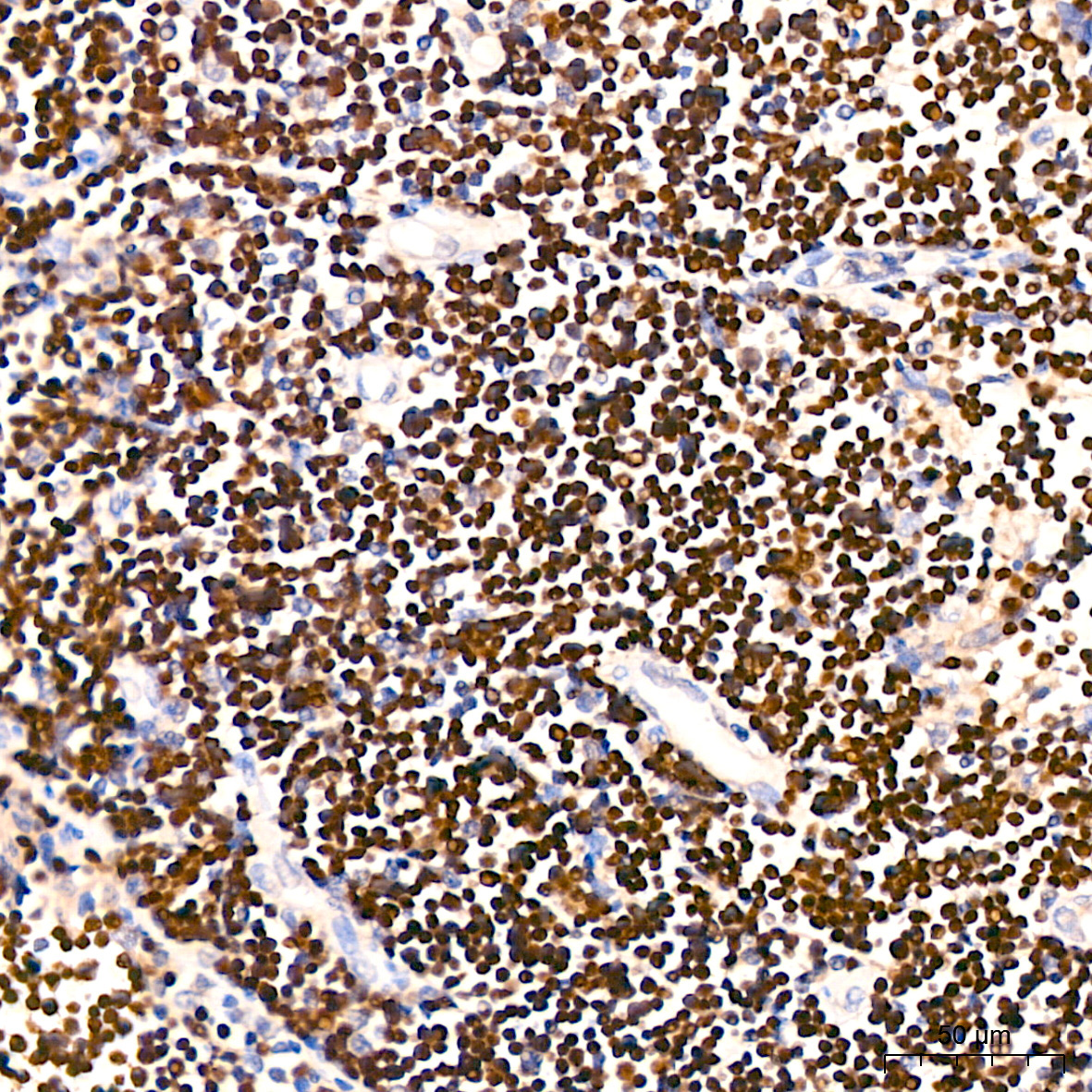 TdT Rabbit Monoclonal Antibody - Image 2