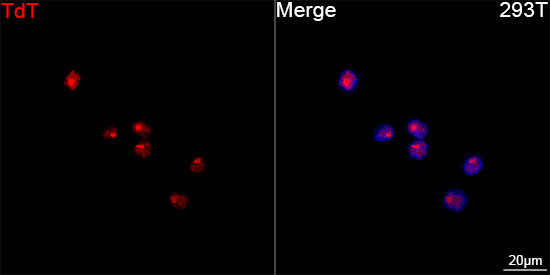 TdT Rabbit Monoclonal Antibody - Image 3