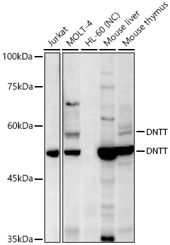 TdT Rabbit Polyclonal Antibody