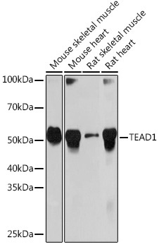 TEAD1 Rabbit Monoclonal Antibody