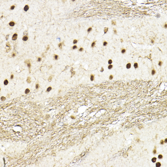 TEAD1 Rabbit Polyclonal Antibody - Image 3