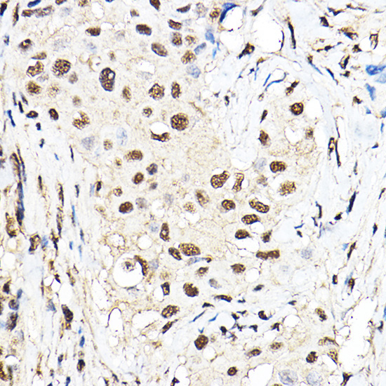 TEAD1 Rabbit Polyclonal Antibody - Image 4