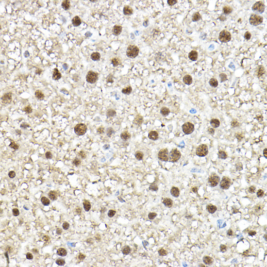 TEAD1 Rabbit Polyclonal Antibody - Image 5